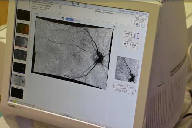 Последно поколение апаратура за очни заболявания във ВМА
