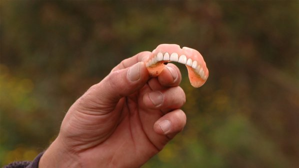 Мъж се задуши със зъбната си протеза по време на секс
