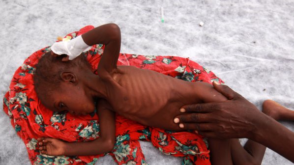 Пет деца умират всяка минута от глад