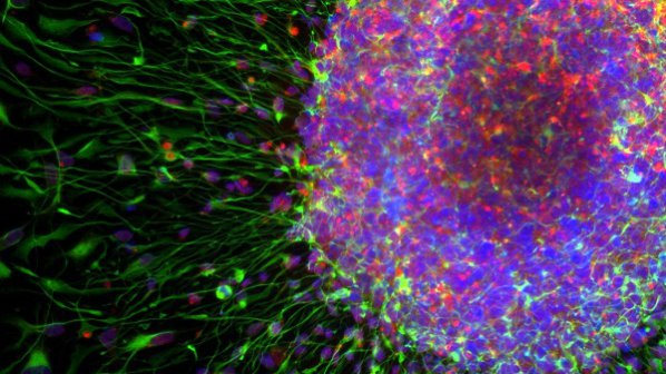 Учени превръщат урина в мозъчни клетки