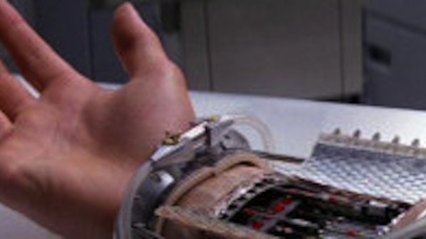 Създадоха бионична ръка