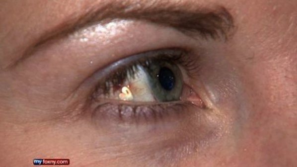 Жена си имплантира платинено бижу в окото