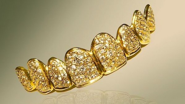 Златни зъбни протези станаха моден хит в Дубай