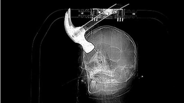 Британец заби чук в главата на любовника си (снимки)