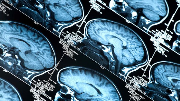 Учените ще предсказват бъдещето по човешкия мозък