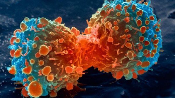 Учени създадоха вирус, който убива рака на панкреаса