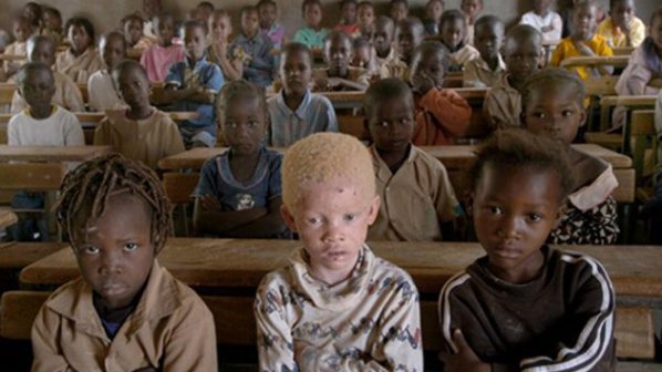 Малави отстрелва преследвачите на албиноси