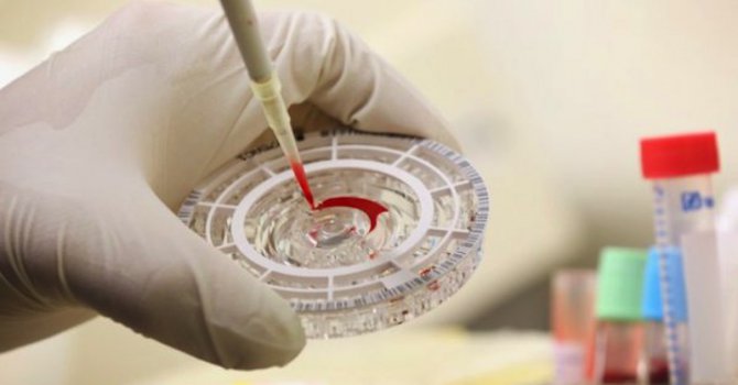 150 болни от хепатит С чакат нов живот с нова революционна терапия
