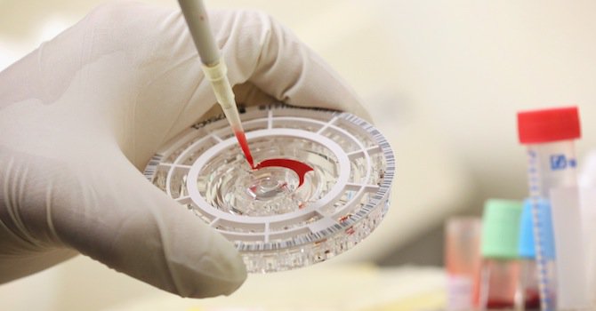 Разпространението на ваксината срещу ебола започва до няколко месеца