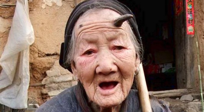 Китайка има 13-сантиметров рог на главата (видео 18+)