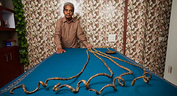 Индиец отгледа нокти с дължина 2 метра (видео)
