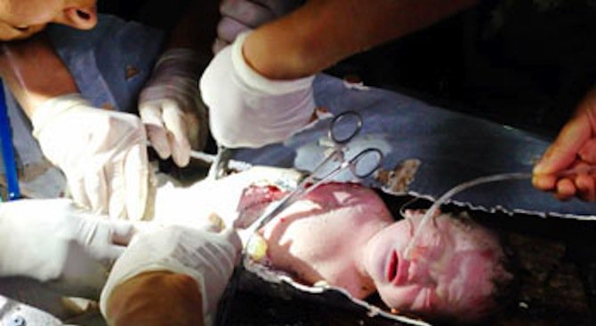 Обявено за мъртво бебе възкръсна в моргата (снимка)