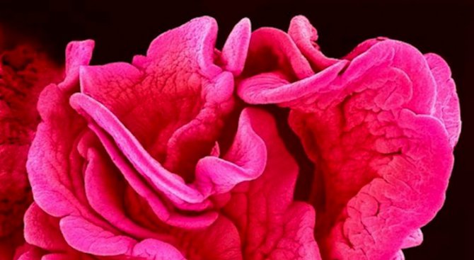 Как изглежда тялото ни под микроскоп (снимки)