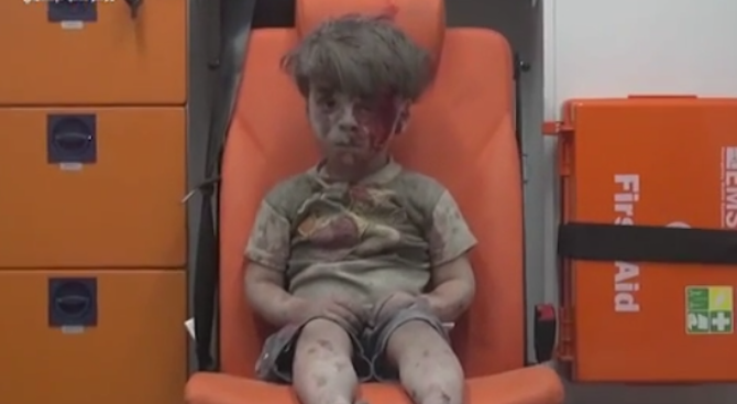 Русия отрече да е замесена в нападението в Алепо, при което е ранен малкият Омран