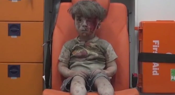 Шокираща снимка на ранено сирийче порази света (видео)