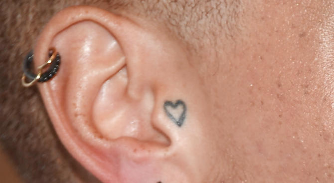 Защо някои хора имат дупка в горния край на ухото?