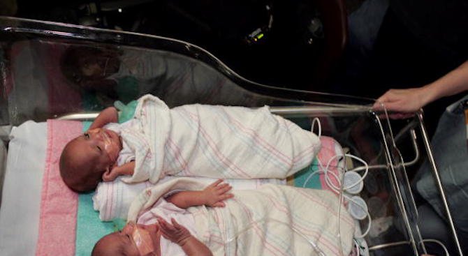 Близнаци се родиха в два различни месеца на различни години (снимка)