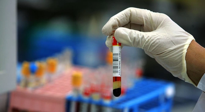 Осем са носителите на ХИВ вируса в Русе Правят безплатни тестове