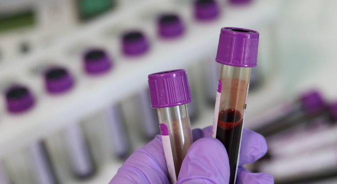 Започват масово тестване за коронавирус във варненската община Дългопол. Инициативата