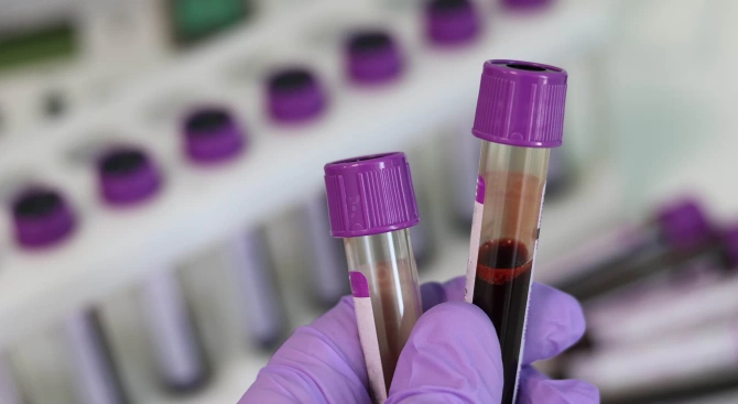 Започват масово тестване за коронавирус във варненската община Дългопол Инициативата