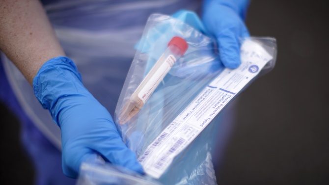 Броят на потвърдените случаи на заразени с коронавируса в Германия