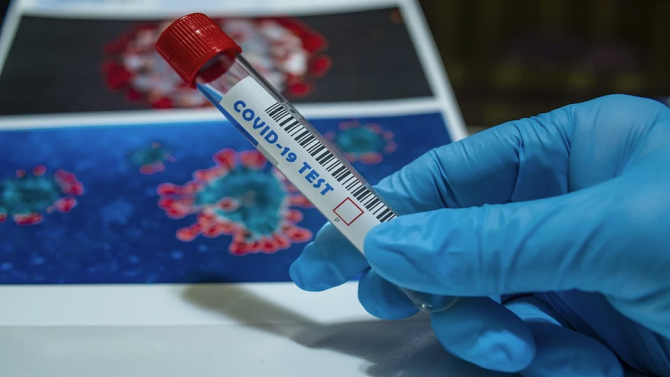 Афганистан се готви за мащабна борба с коронавируса