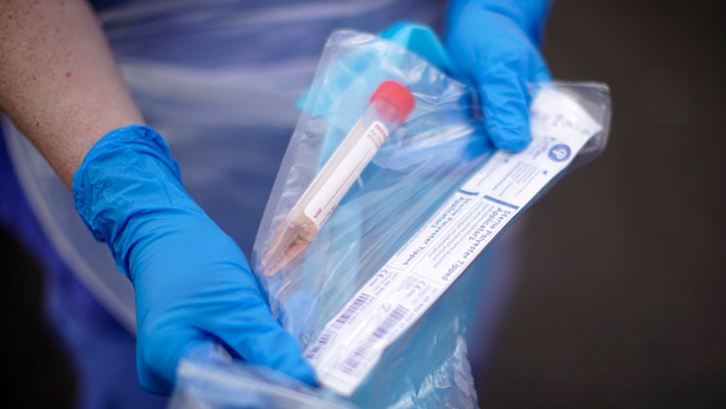Втори случай на починал от коронавирус е регистриран в Перник