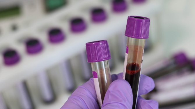 Излязоха пробите за коронавирус на персонала на белодробното отделение в Ловеч