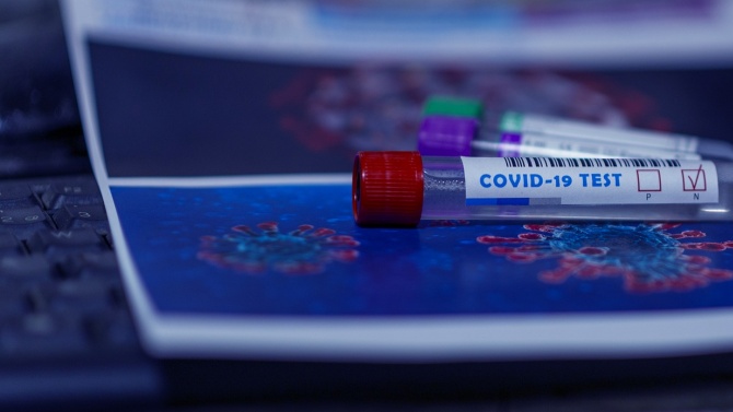 Излекувани са вече 131 от заразените с коронавирус в Шуменско,