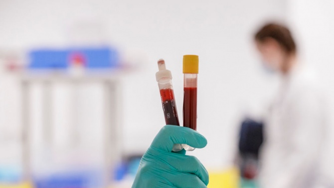 Трима новозаразени с коронавирус в Смолянско за 24 часа