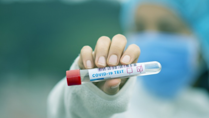 Учени: Тестовете не са недостатъчни за справяне с COVID-19