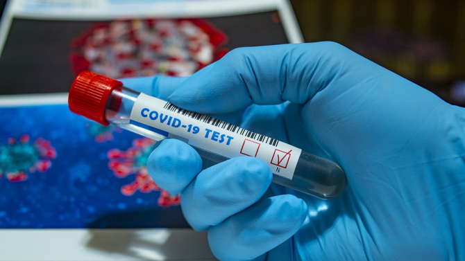 62 души от дома за възрастни хора "Възраждане" в Русе са излекувани от коронавирус