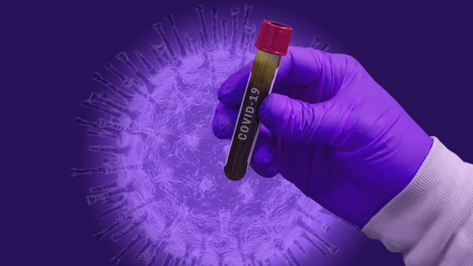 Франция съобщи за 8577 нови случая на зараза с коронавируса