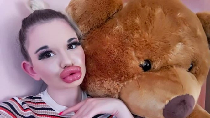 21 ва операция на устните си направи българското Барби Андреа Иванова Блондинката
