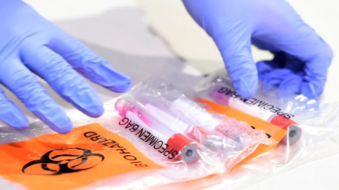 Нови 10 случая на коронавирус са регистрирани в Ямболска област