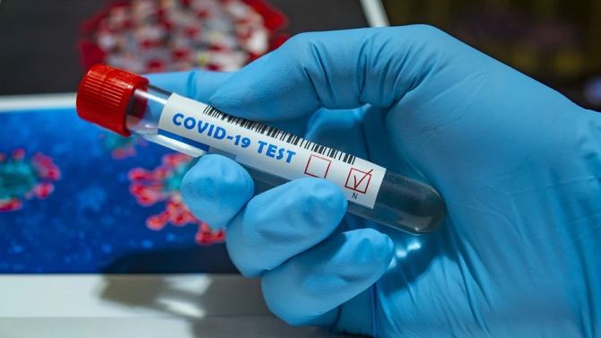  86% от инфектираните с COVID-19 нямат признаци в деня на теста 