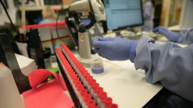  Провeряват лабораториите, в които се вършат PCR проби за COVID-19 
