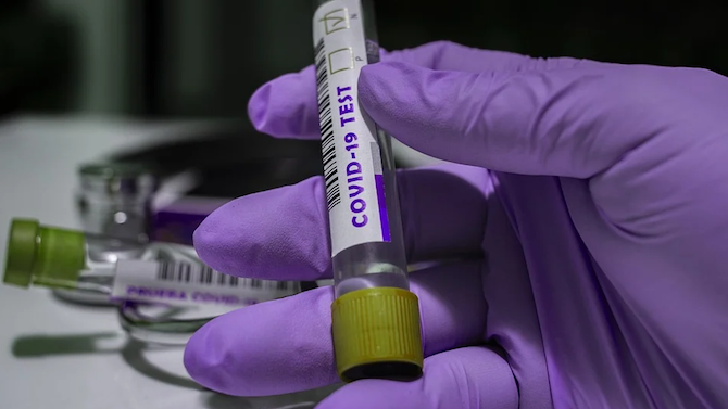  Референтна лаборатория за PCR проби проработи в Коронавирус болничното заведение в Пловдив 