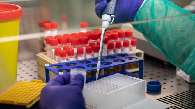  Лаборатория прави платени PCR проби, само че не ги регистрира 