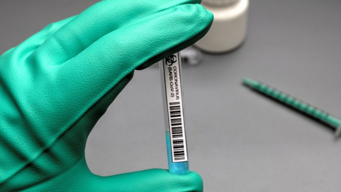  Приравниха антигенните проби към PCR-ите 