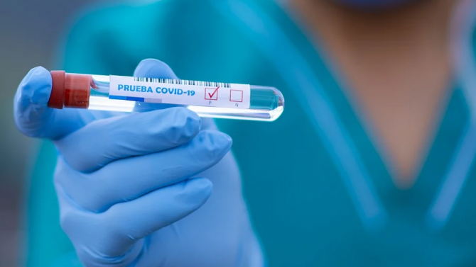 Рекордни над 6300 нови случая на коронавирус през последното денонощие в Словакия