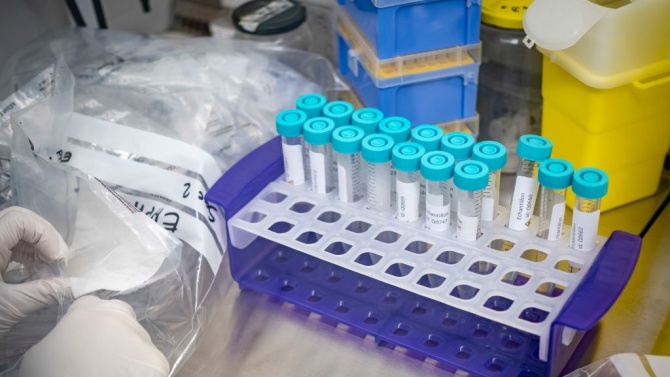  Д-р Мими Виткова: Леко пораства процентът на позитивните PCR проби 