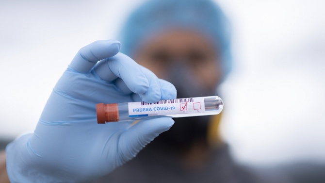 Новите случаи на коронавирус у нас за последното денонощие надхвърлят 900