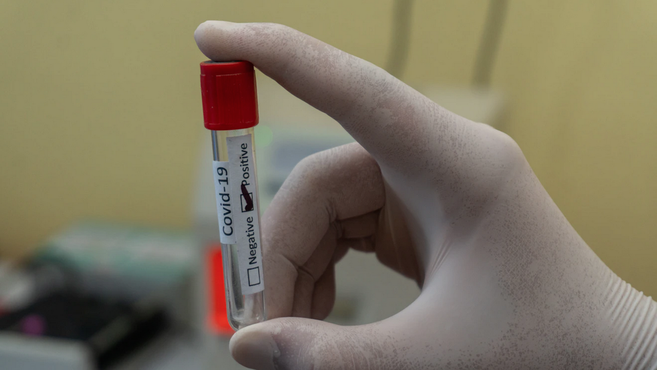 Най-малък брой нови случаи на коронавирус в Русия от началото на октомври
