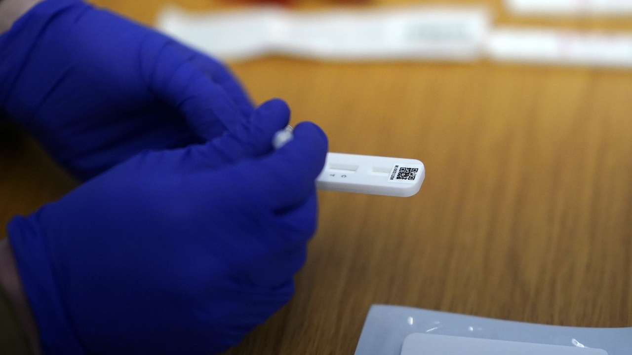Недостиг на тестове за антитела в  лаборатория в Пловдив 