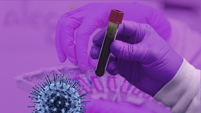 Великобритания постави нов рекорд на новозаразени с коронавируса
