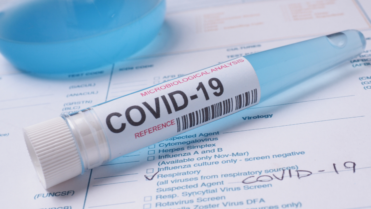 Заболеваемостта от COVID-19 в Монтанско расте бавно - хоспитализациите не