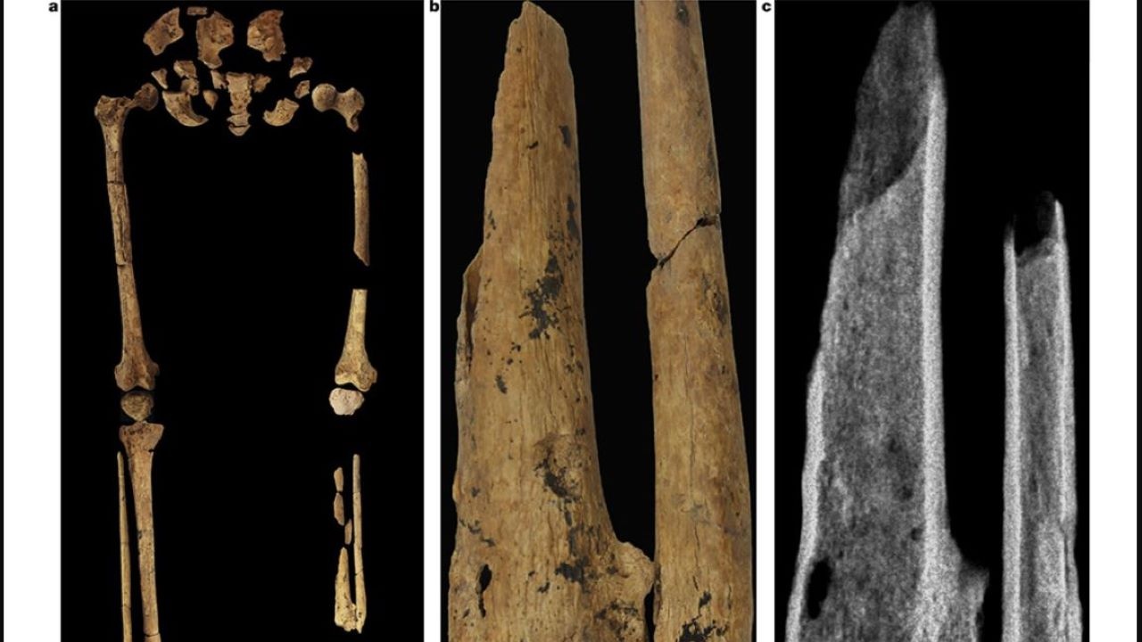 Откриха скелет от каменната ера с ампутиран крак