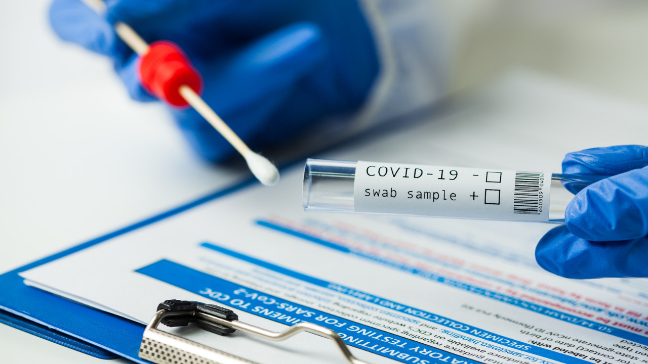 219 са новите случаи на коронавирус
