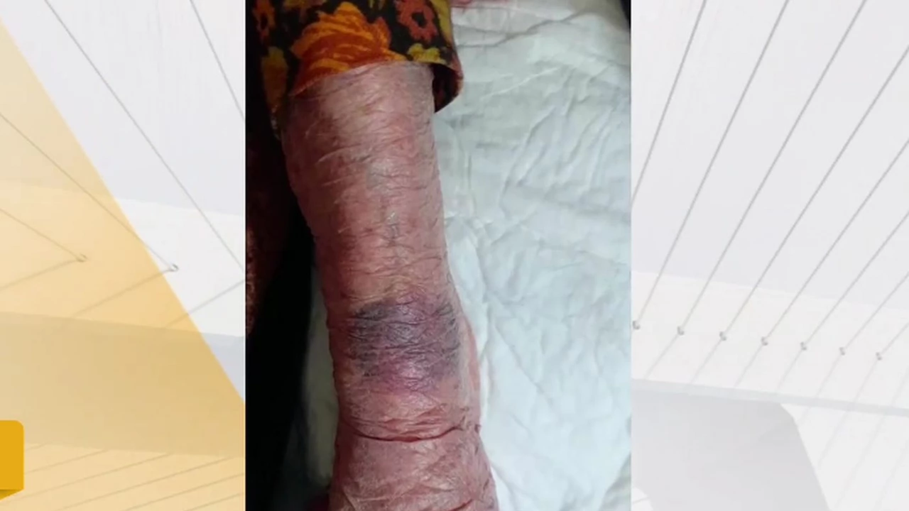 104 годишна жена е връзвана за крайниците докато е била